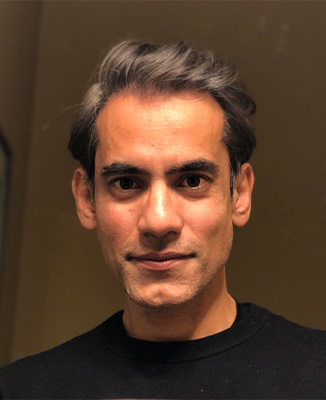 Nova Dental | All-on-6 reg , Extractions and Dental Bridges