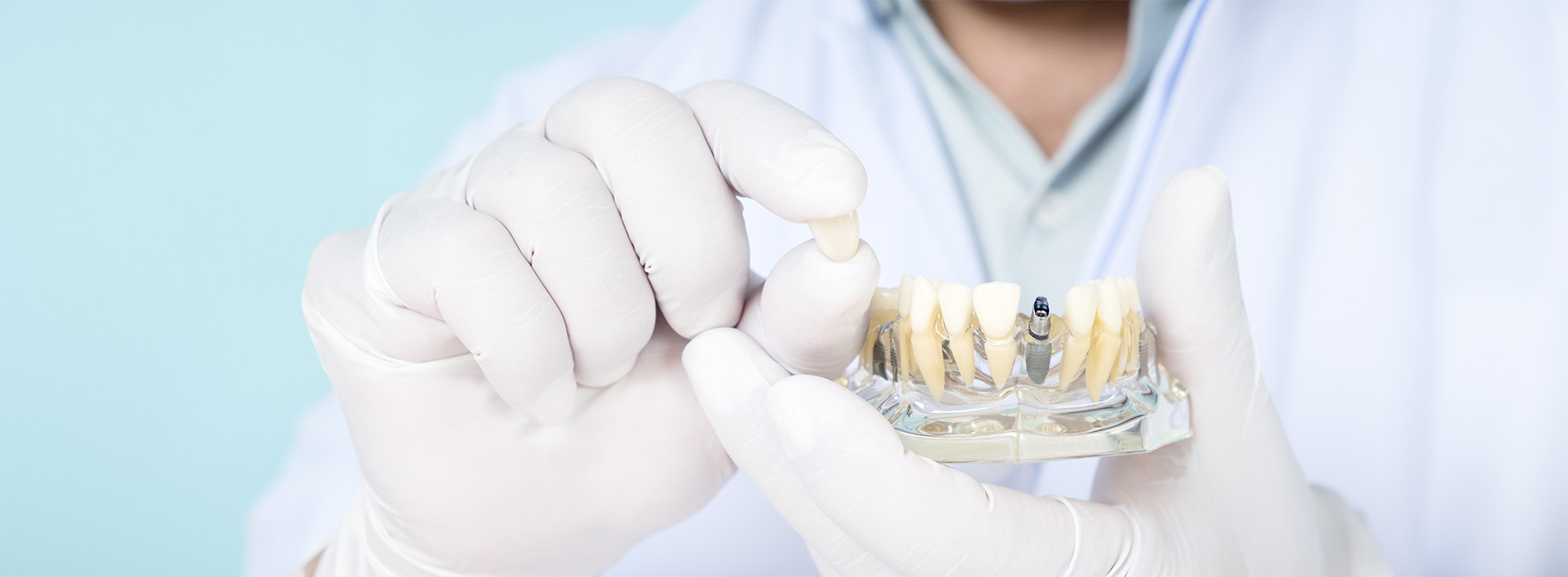 Nova Dental | Oral Exams, All-on-6 reg  and Dental Cleanings