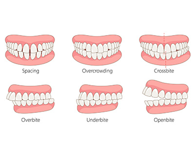Nova Dental | ClearCorrect reg , Periodontal Treatment and Orthodontics