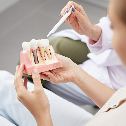 A person holding a dental model with a drill, demonstrating dental work.