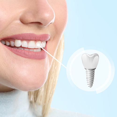 The image shows a close-up of a person s face with a focus on a tooth being straightened by an orthodontic appliance, accompanied by a graphic representation of the appliance itself.