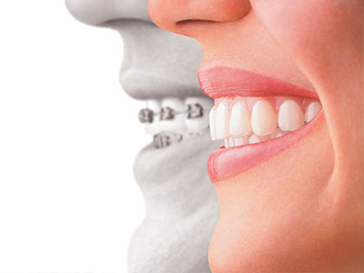 The image displays a split-screen comparison between a person s natural teeth and an alternative, possibly a dental implant or bridge.