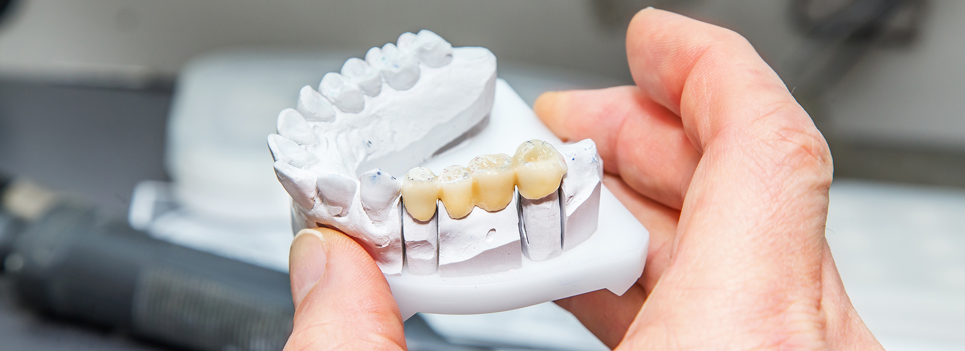 Nova Dental | Sedation Dentistry, Emergency Treatment and Traditional Metal Braces