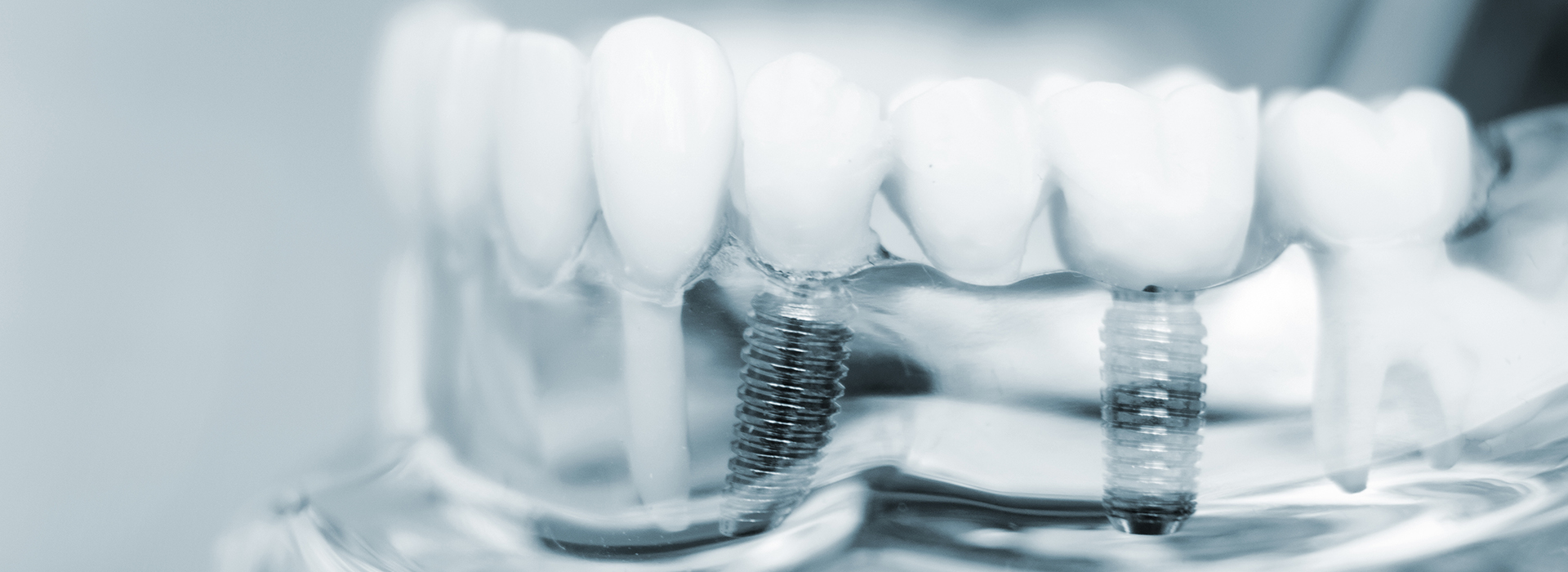 Nova Dental | Botox reg , Periodontal Treatment and Dental Fillings