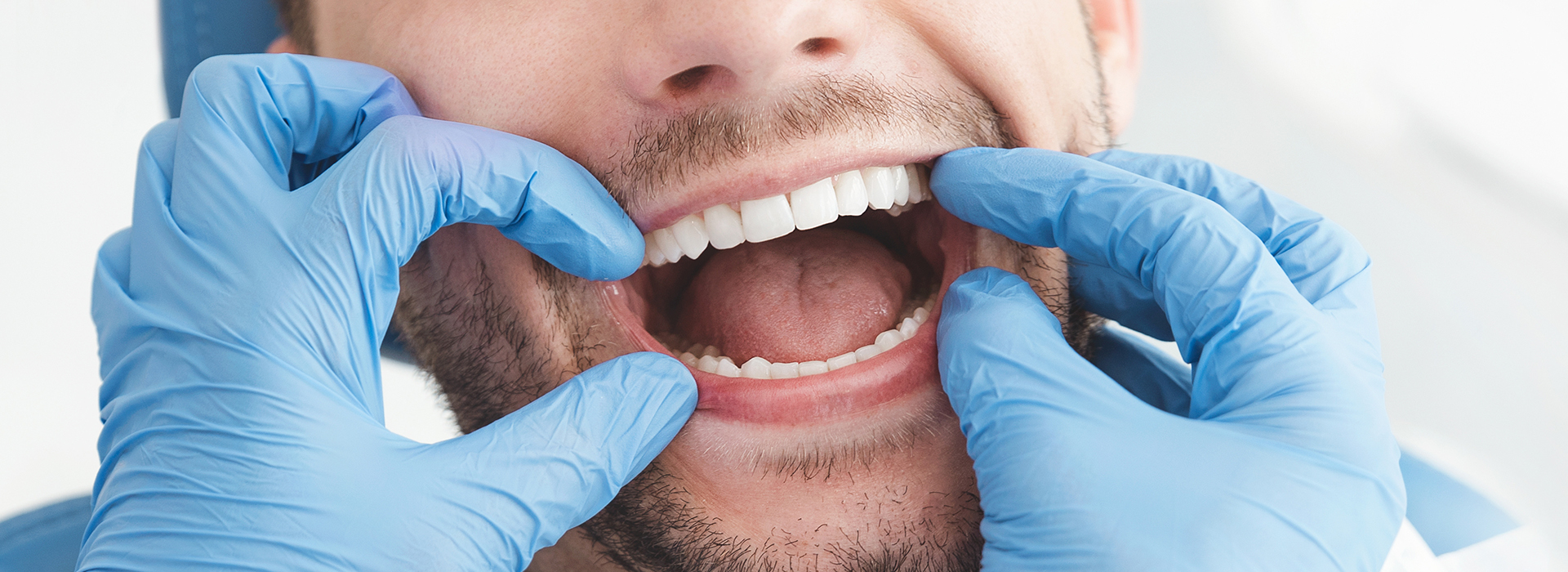 Nova Dental | Invisalign reg , Dental Cleanings and Ceramic Crowns