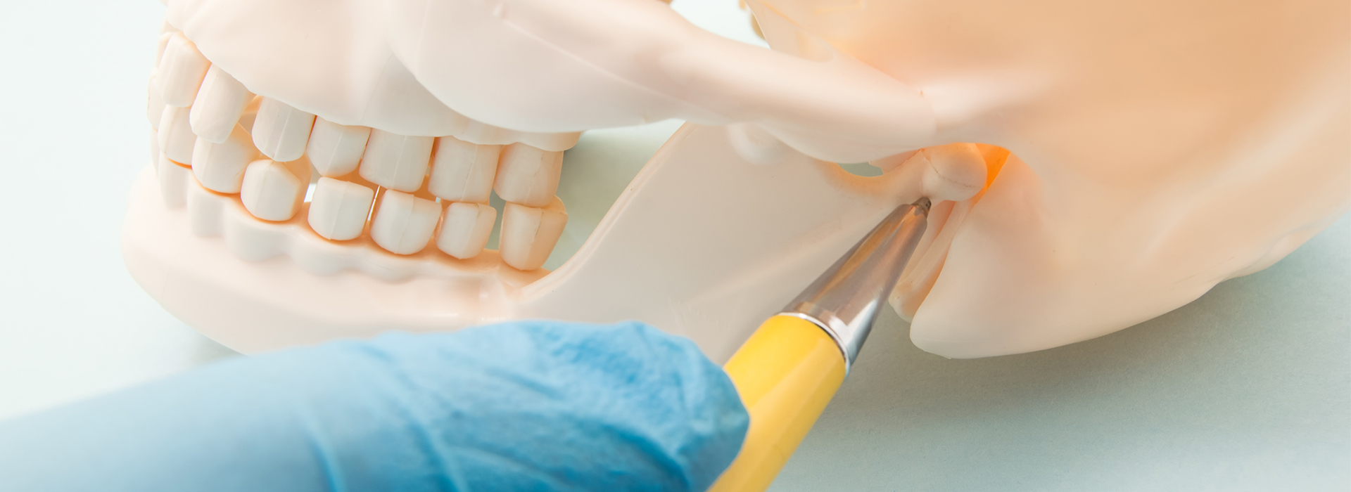 Nova Dental | Night Guards, Inlays  amp  Onlays and Teeth Whitening