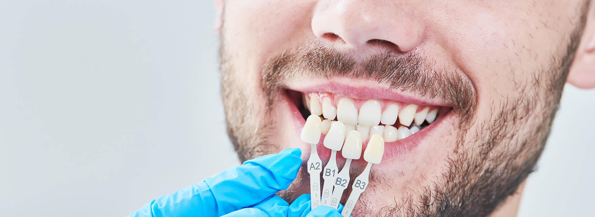 Nova Dental | Night Guards, Oral Exams and ClearCorrect reg 
