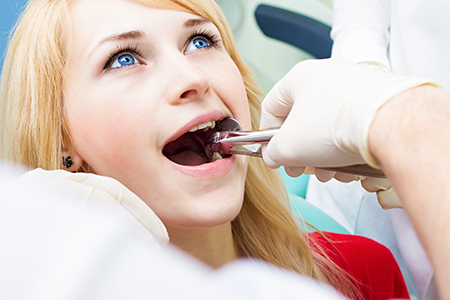 A woman undergoing dental treatment, with her mouth open wide, receiving care from a professional in a clinical setting.