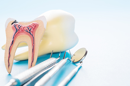 The image shows two different views of a dental model with an open mouth, placed on a table alongside dental tools such as tweezers and a toothbrush, against a blue background.
