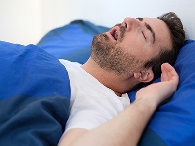 Nova Dental | ClearCorrect reg , Night Guards and Fluoride Treatment